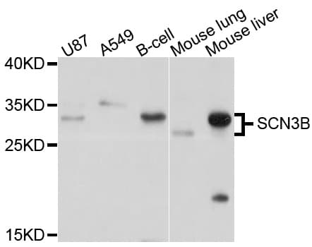 Polyclonal Rabbit anti-Human SCN3B Antibody (WB)
