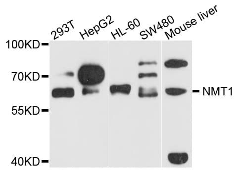 NMT1 Antibody