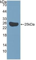 BIRC5 / Survivin Antibody (aa1-140, APC)