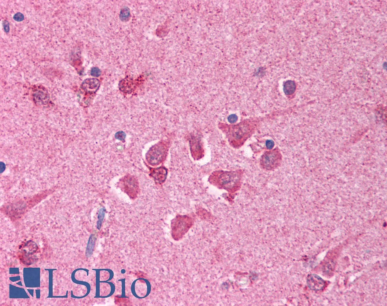 PathPlus™ BCL10 / BCL-10 Antibody (aa5-19)