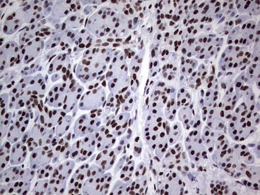 Monoclonal Mouse anti-Human PPP1R8 / Rnase E Antibody (clone OTI4E5, aa1-225, IHC, WB)