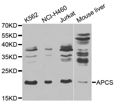 PathPlus™ Polyclonal Rabbit anti-Human APCS / Serum Amyloid P / SAP Antibody (IHC, WB)