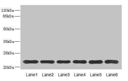 SAR1A / SAR1 Antibody