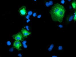 PSMD2 Antibody (clone OTI1G8)