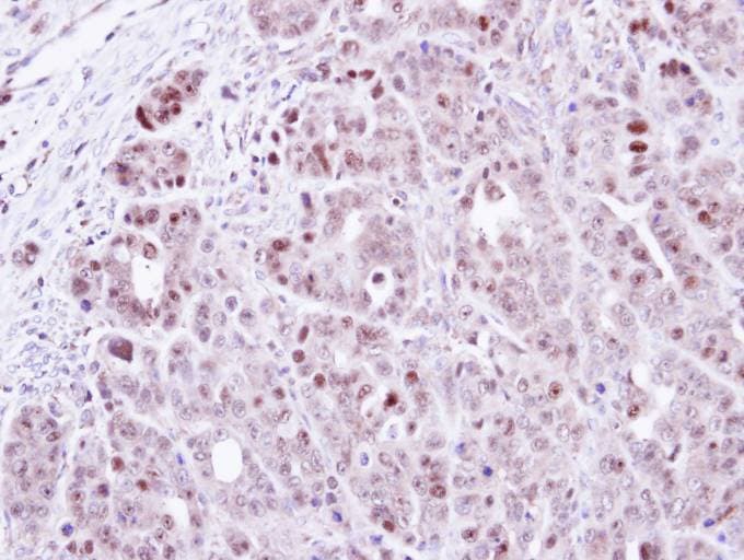 TSPYL1 Antibody (aa1-203)