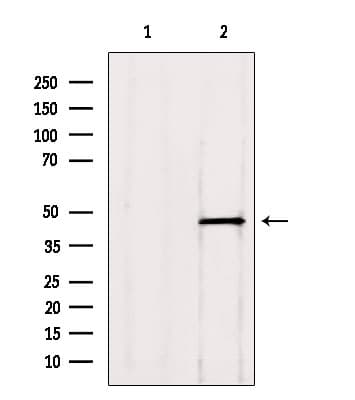 Polyclonal Rabbit anti-Human ADRM1 Antibody (IHC, IF, WB)