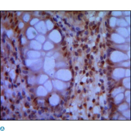SMC1A / SMC1 Antibody