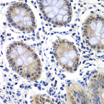 RAP30 / GTF2F2 Antibody