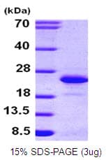 Human FGF12 Protein (Recombinant His)