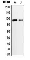 Polyclonal Rabbit anti-Human ANKRD20A3 Antibody (Internal, IHC, WB)