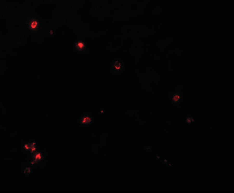 IHC-plus™ NDUFB9 Antibody
