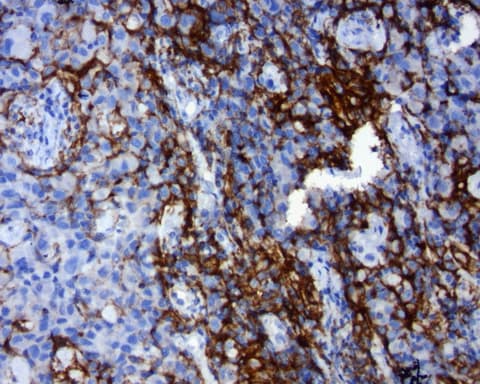 CD274 / B7-H1 / PD-L1 Antibody (C-Terminus, clone OR-5E3)