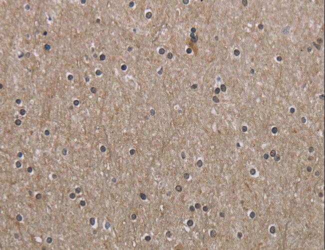 PPAT Antibody