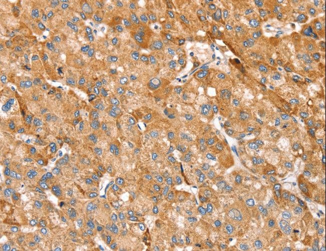 TRIM45 Antibody