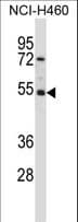 Polyclonal Rabbit anti-Human GTF2A1L / ALF Antibody (aa399-428, WB)