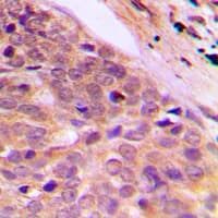 Polyclonal Rabbit anti-Human SLC4A1AP / Kanadaptin Antibody (Internal, IHC, IF, WB)