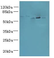 ADAT1 Antibody