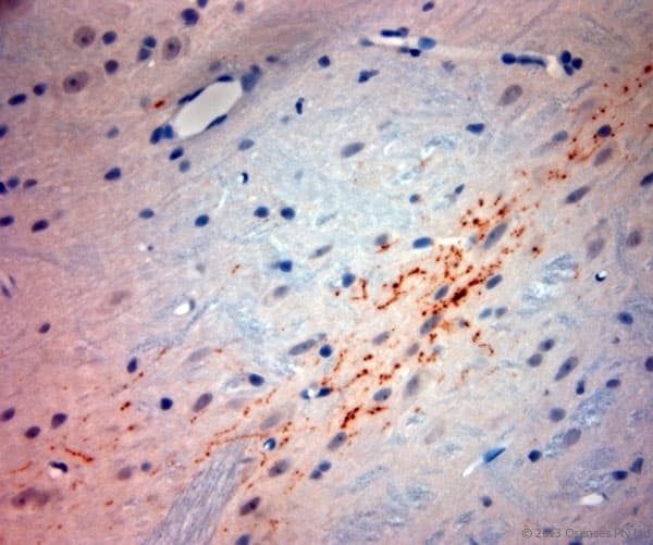 Polyclonal Rabbit anti-Rat SYNPO / Synaptopodin Antibody (aa890-930, IHC)