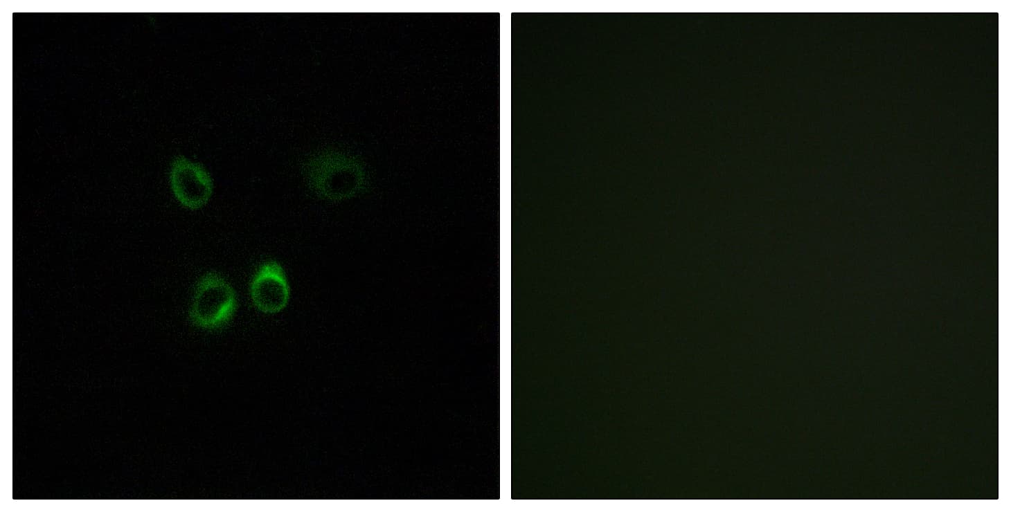 Polyclonal Rabbit anti-Human RGR Antibody (aa169-218, IHC, IF)