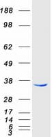 Human RDH14 Protein (Recombinant Myc-DDK (Flag))