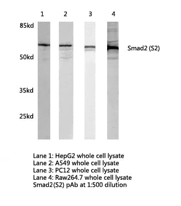 Polyclonal Rabbit anti-Human SMAD2 Antibody (Ser2, WB)