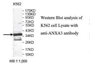 Polyclonal Rabbit anti-Human ANXA3 / Annexin A3 Antibody (aa2-207, IHC, WB)