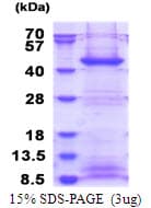Human FBXO2 Protein (Recombinant His)