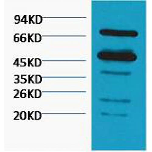 RuBisCO Antibody