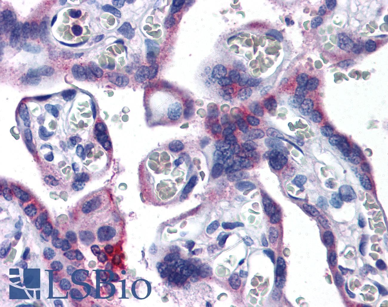 IHC-plus™ Polyclonal Goat anti-Human EVC2 Antibody (aa1296-1308, IHC)