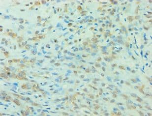 YWHAQ / 14-3-3 Theta Antibody (aa1-245)