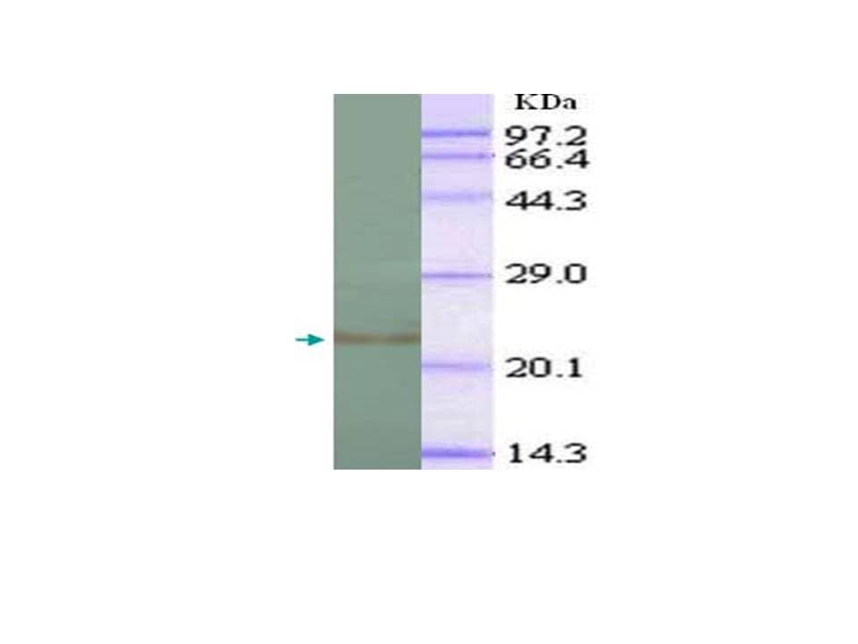 Monoclonal Mouse anti-Human IL-1B / IL-1 Beta Antibody (aa118-269, IHC, WB)