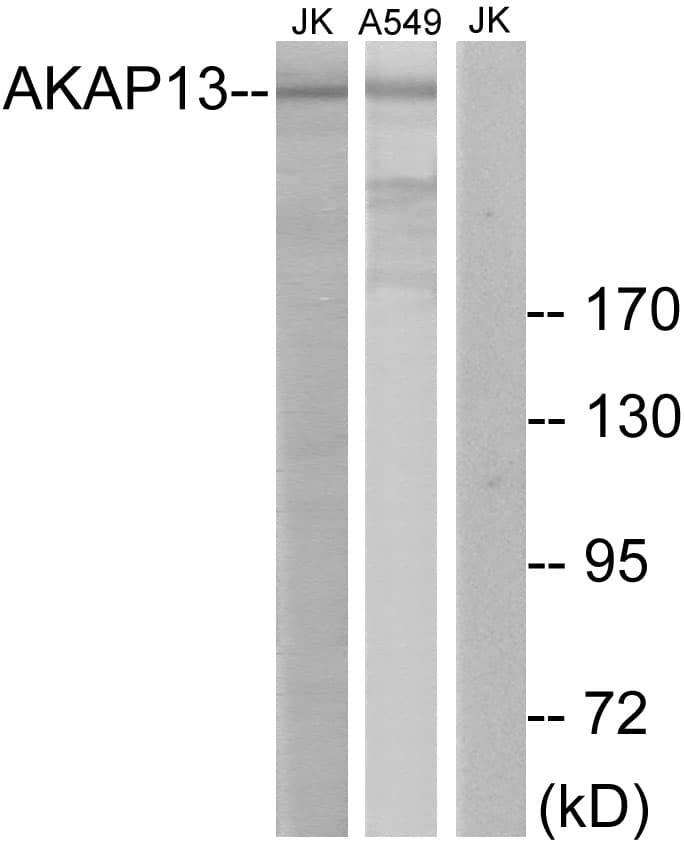 LBC / AKAP13 Antibody (aa721-770)