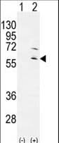 RPS6KL1 Antibody