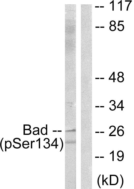 Polyclonal Rabbit anti-Human BAD Antibody (phospho-Ser134, IHC, IF, WB)