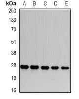 Polyclonal Rabbit anti-Human PSMA6 Antibody (IHC, IF, WB)
