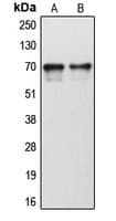 CYP1B1 Antibody (Internal)
