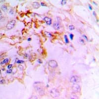 Polyclonal Rabbit anti-Human CCL5 / RANTES Antibody (IHC, WB)
