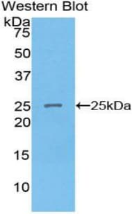 SPRY2 / Sprouty 2 Antibody (aa116-305)