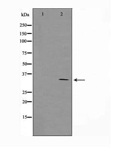 CCND1 / Cyclin D1 Antibody