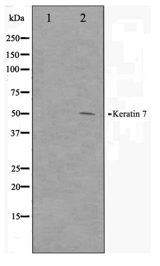 MKI67 / Ki67 Antibody