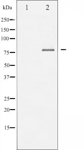 FOXO1 / FKHR Antibody (phospho-Thr24,pThr32)