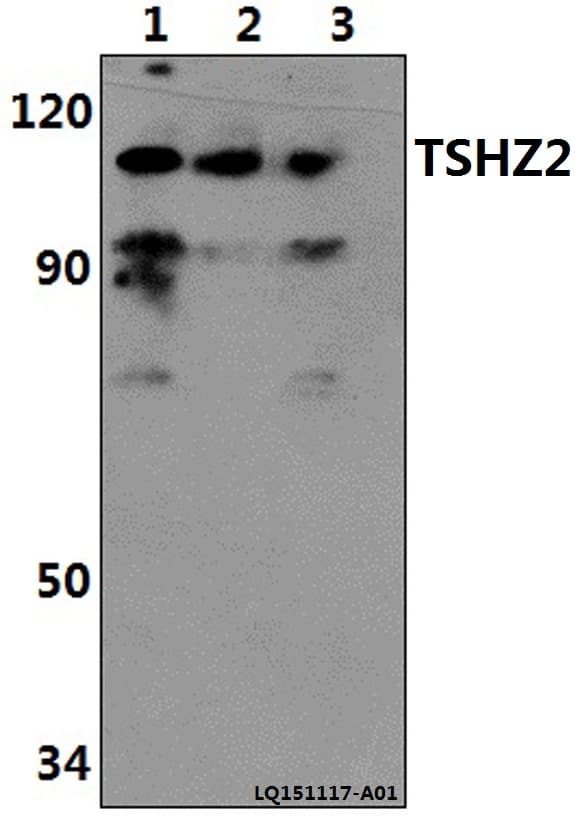 Polyclonal Rabbit anti-Human TSHZ2 Antibody (WB)