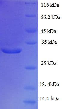 Human TAF12 Protein (Recombinant His-SUMO)