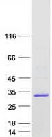 Human CABP2 Protein (Recombinant Myc-DDK (Flag))