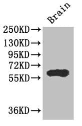Polyclonal Rabbit anti-Human ICE1 Antibody (IHC, WB)