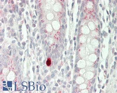IHC-plus™ Polyclonal Rabbit anti-Human SIAH2 Antibody (C-Terminus, IHC, IF, WB)
