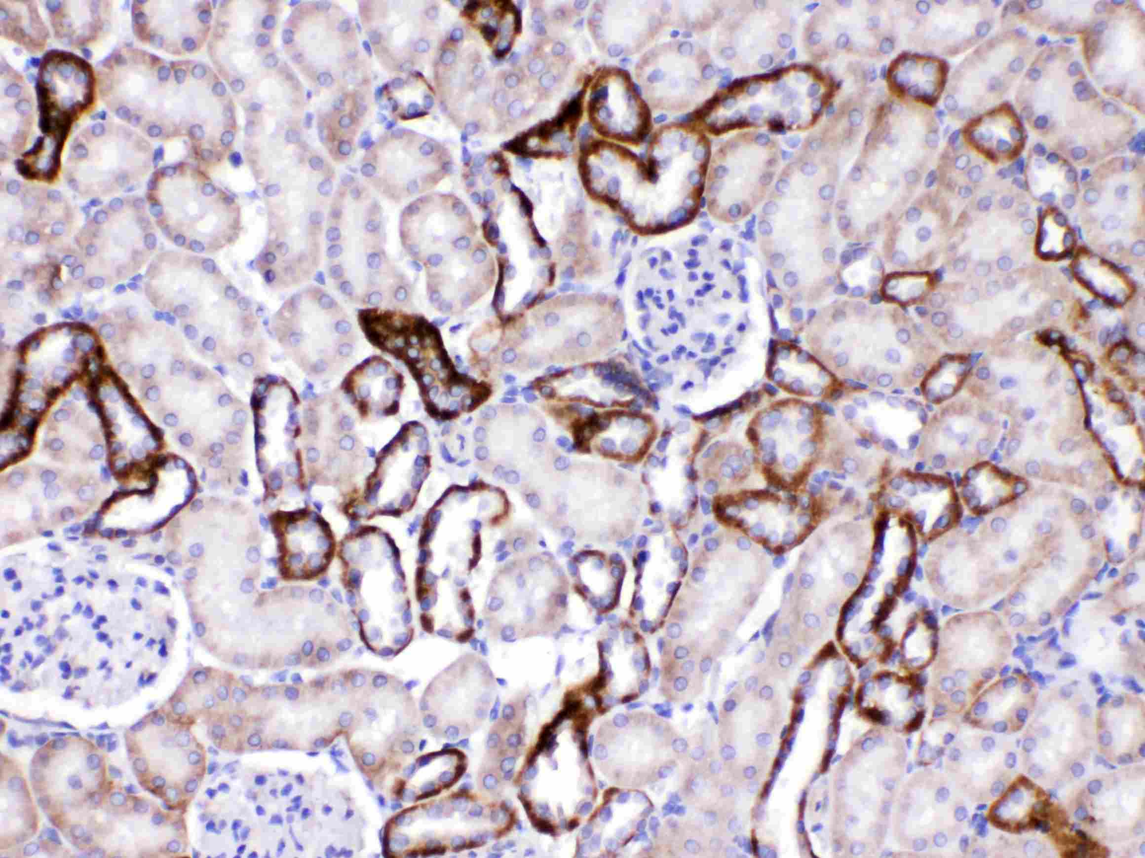 Polyclonal Rabbit anti-Human GAD65 Antibody (IHC, WB)