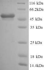 Mouse GFAP Protein (Recombinant 6His, N-terminus)