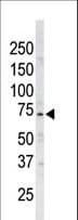 Polyclonal Rabbit anti-Human NUAK1 / ARK5 Antibody (aa1-30, IHC, WB)