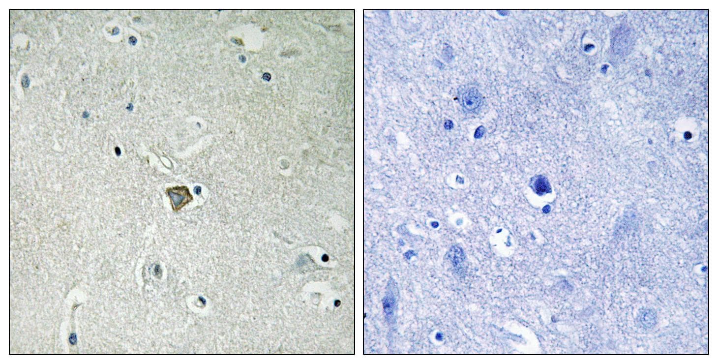Polyclonal Rabbit anti-Human BAX Antibody (aa143-192, IHC)